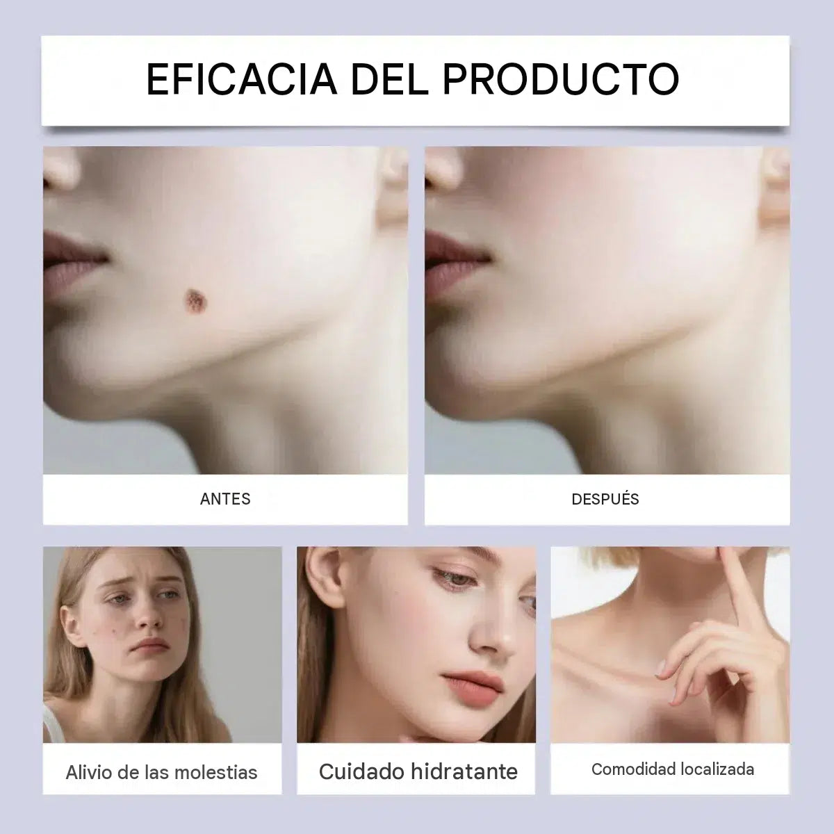 Spray con efecto frío: Elimina verrugas y protuberancias
